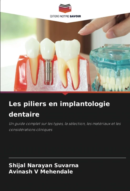 Les piliers en implantologie dentaire: Un guide complet sur les types, la sélection, les matériaux et les considérations cliniques - Image 1