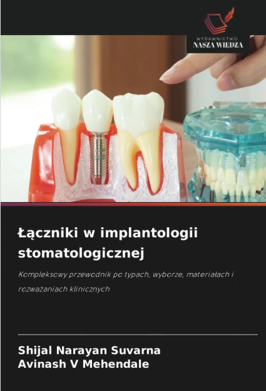 Łączniki w implantologii stomatologicznej: Kompleksowy przewodnik po typach, wyborze, materiałach i rozważaniach klinicznych: Kompleksowy przewodnik ... materia¿ach i rozwa¿aniach klinicznych
