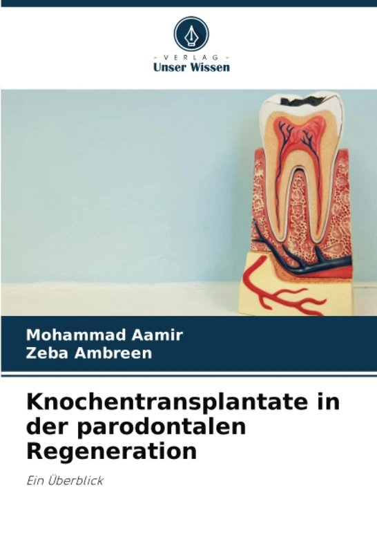 Knochentransplantate in der parodontalen Regeneration: Ein Überblick - Image 1