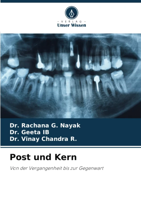 Post und Kern: Von der Vergangenheit bis zur Gegenwart