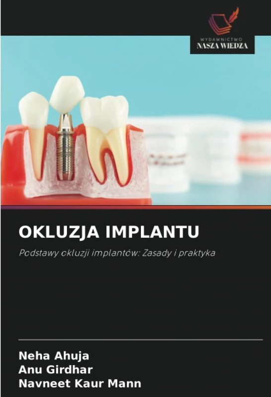 OKLUZJA IMPLANTU: Podstawy okluzji implantów: Zasady i praktyka