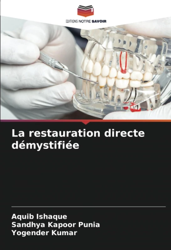 La restauration directe démystifiée
