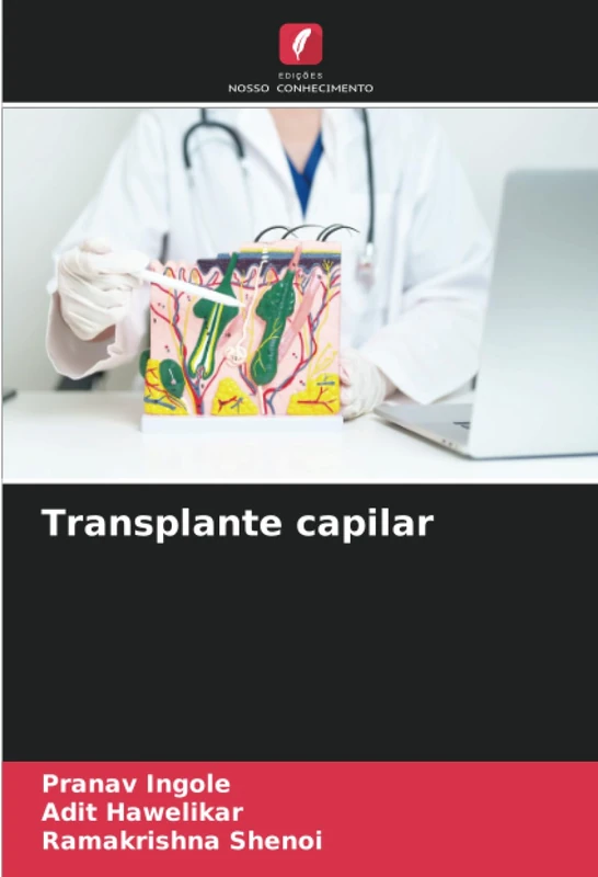 Transplante capilar