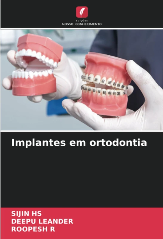 Implantes em ortodontia
