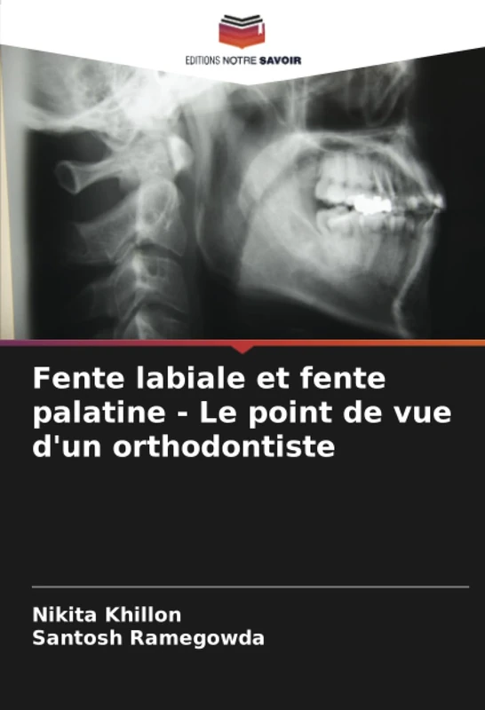 Fente labiale et fente palatine - Le point de vue d'un orthodontiste