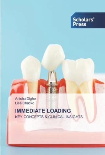 IMMEDIATE LOADING: KEY CONCEPTS & CLINICAL INSIGHTS