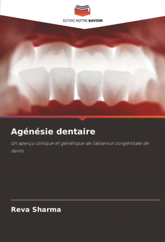 Agénésie dentaire: Un aperçu clinique et génétique de l'absence congénitale de dents