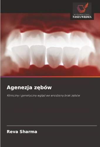 Agenezja zębów: Kliniczny i genetyczny wgląd we wrodzony brak zębów