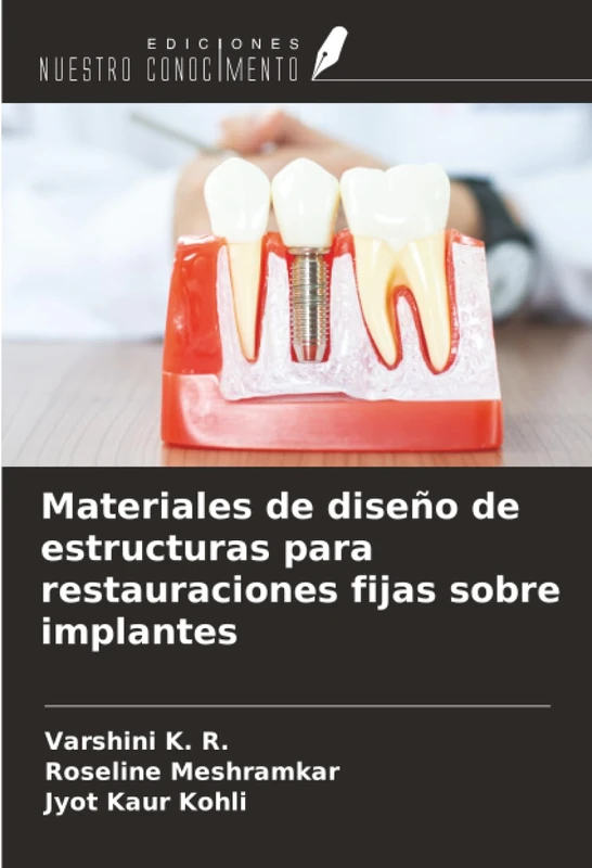 Materiales de diseño de estructuras para restauraciones fijas sobre implantes