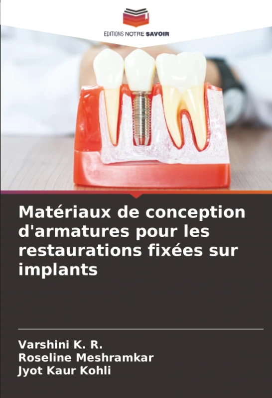 Matériaux de conception d'armatures pour les restaurations fixées sur implants