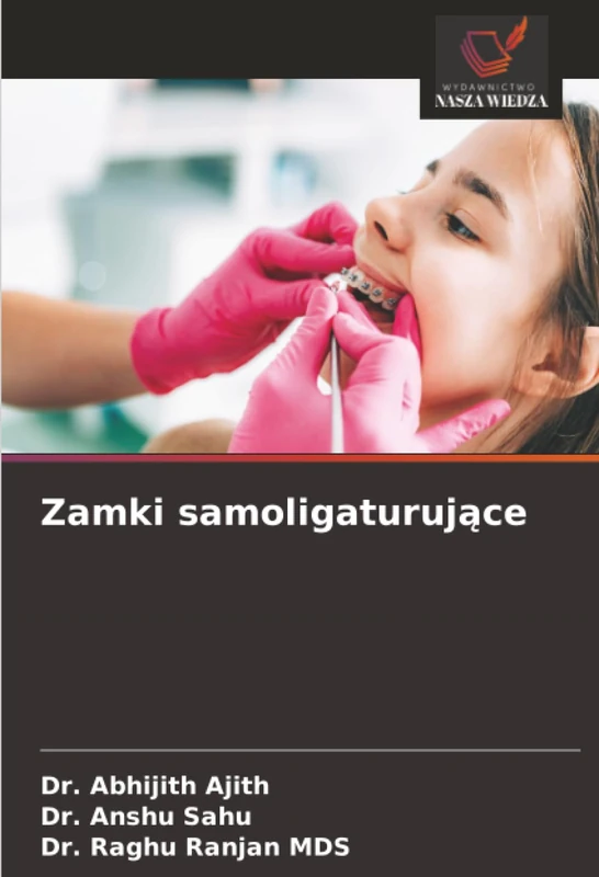 Zamki samoligaturujące