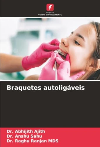 Braquetes autoligáveis