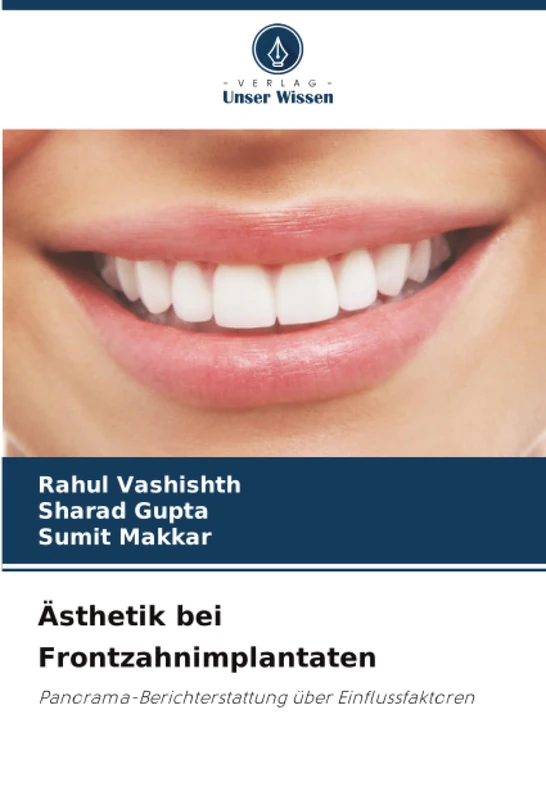 Ästhetik bei Frontzahnimplantaten: Panorama-Berichterstattung über Einflussfaktoren
