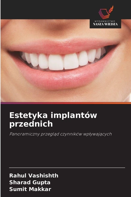 Estetyka implantów przednich: Panoramiczny przegl¿d czynników wp¿ywaj¿cych