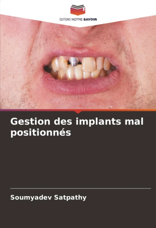 Gestion des implants mal positionnés
