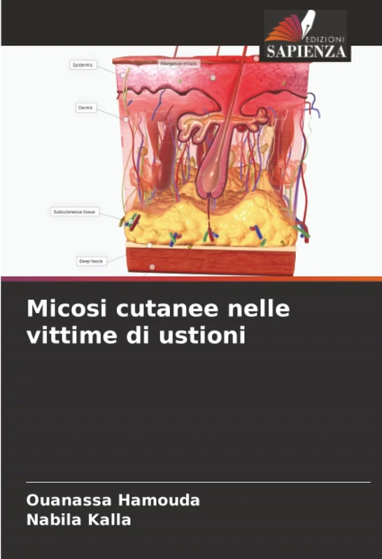 Micosi cutanee nelle vittime di ustioni