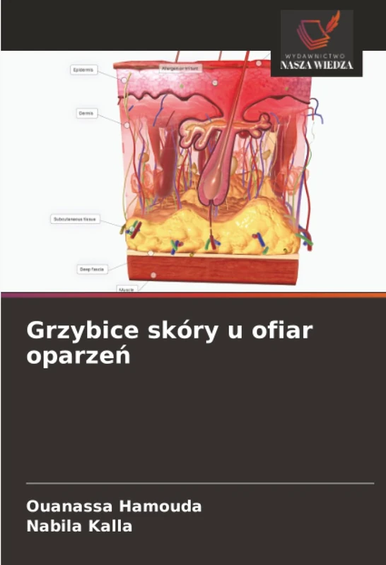 Grzybice skóry u ofiar oparzeń