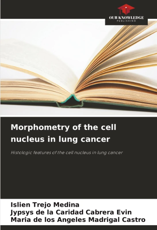 Morphometry of the cell nucleus in lung cancer: Histologic features of the cell nucleus in lung cancer - Image 1