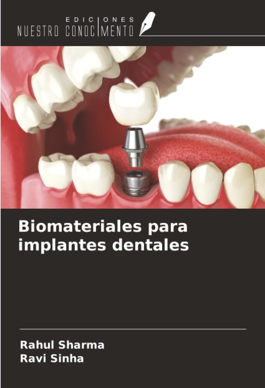 Biomateriales para implantes dentales
