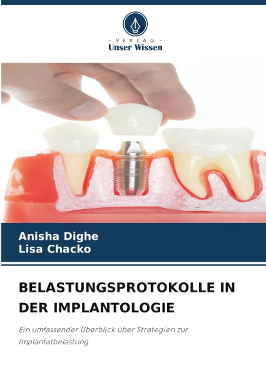 BELASTUNGSPROTOKOLLE IN DER IMPLANTOLOGIE: Ein umfassender Überblick über Strategien zur Implantatbelastung