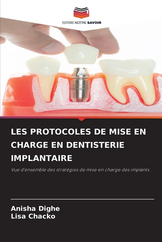 LES PROTOCOLES DE MISE EN CHARGE EN DENTISTERIE IMPLANTAIRE: Vue d'ensemble des stratégies de mise en charge des implants