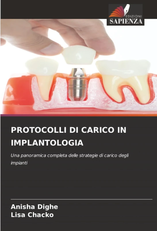 PROTOCOLLI DI CARICO IN IMPLANTOLOGIA: Una panoramica completa delle strategie di carico degli impianti