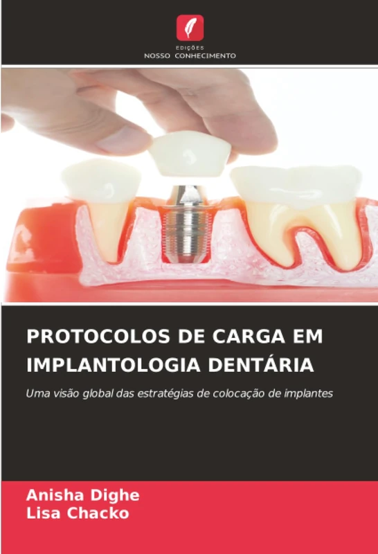 PROTOCOLOS DE CARGA EM IMPLANTOLOGIA DENTÁRIA: Uma visão global das estratégias de colocação de implantes