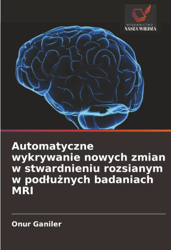 Automatyczne wykrywanie nowych zmian w stwardnieniu rozsianym w podłużnych badaniach MRI