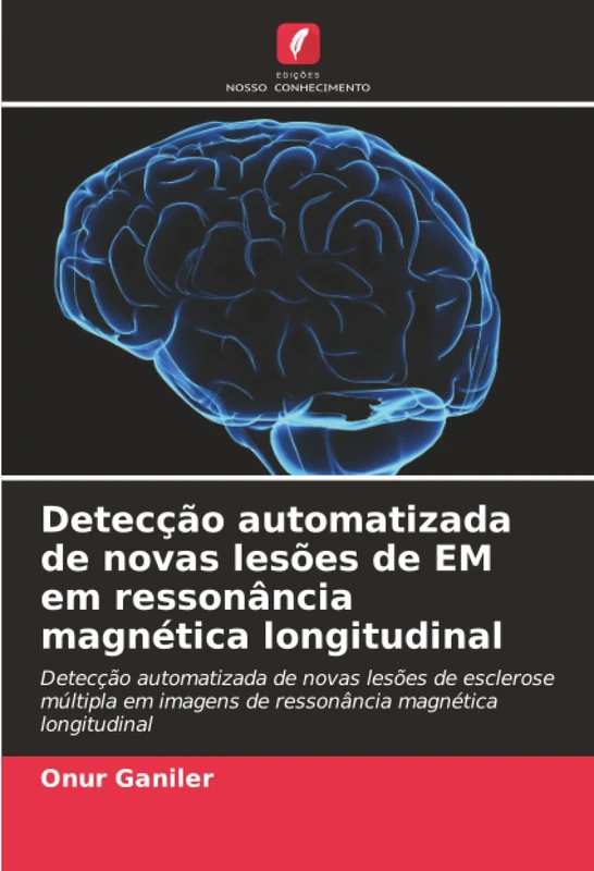 Detecção automatizada de novas lesões de EM em ressonância magnética longitudinal: Detecção automatizada de novas lesões de esclerose múltipla em imagens de ressonância magnética longitudinal - Image 1