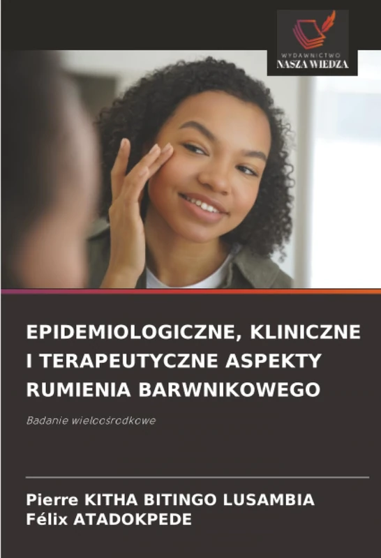 EPIDEMIOLOGICZNE, KLINICZNE I TERAPEUTYCZNE ASPEKTY RUMIENIA BARWNIKOWEGO: Badanie wieloośrodkowe