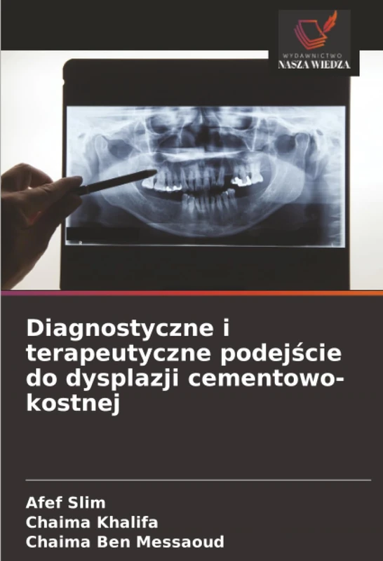 Diagnostyczne i terapeutyczne podejście do dysplazji cementowo-kostnej - Image 1