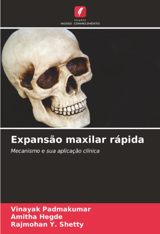 Expansão maxilar rápida: Mecanismo e sua aplicação clínica