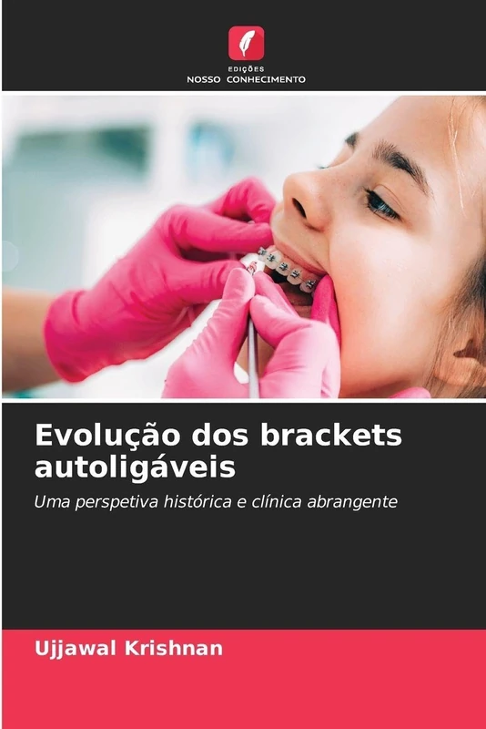Evolução dos brackets autoligáveis: Uma perspetiva histórica e clínica abrangente