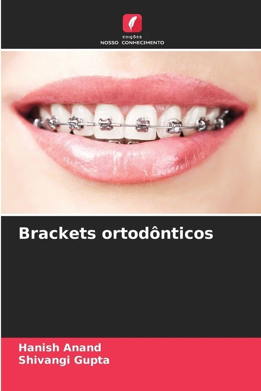 Brackets ortodônticos