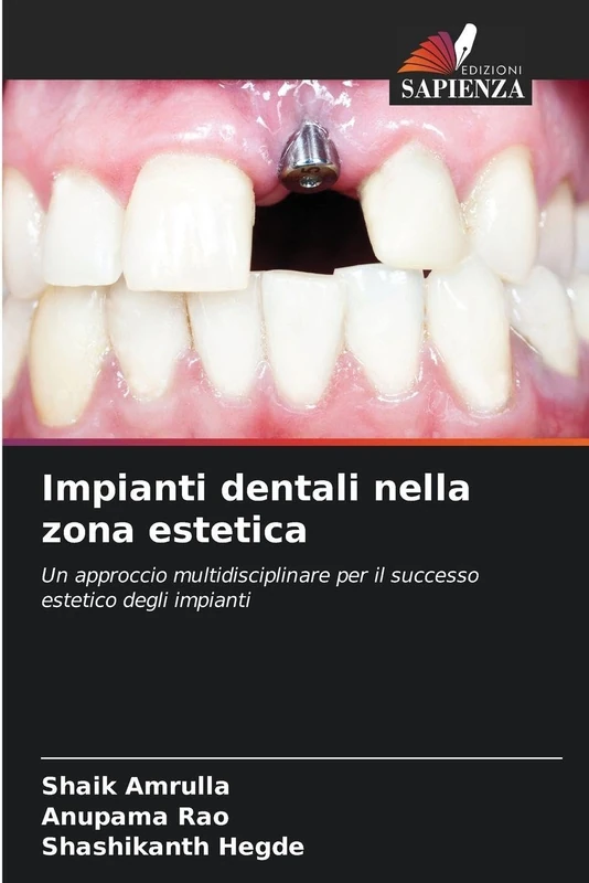 Impianti dentali nella zona estetica: Un approccio multidisciplinare per il successo estetico degli impianti