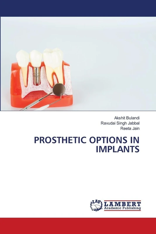 Prosthetic Options in Implants