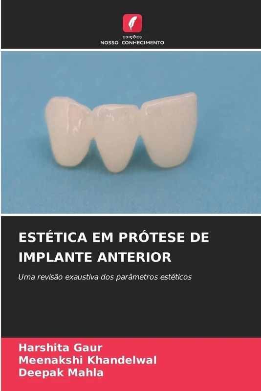Estética Em Prótese de Implante Anterior: Uma revisão exaustiva dos parâmetros estéticos