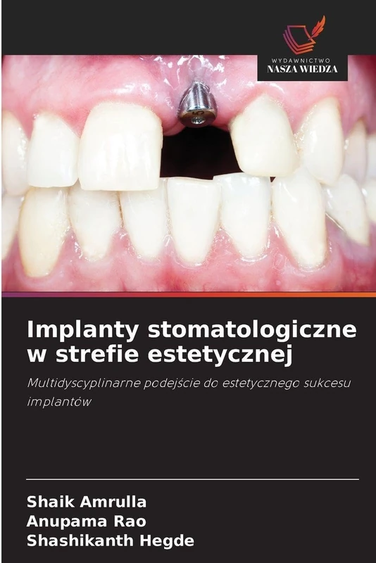 Implanty stomatologiczne w strefie estetycznej: Multidyscyplinarne podej¿cie do estetycznego sukcesu implantów