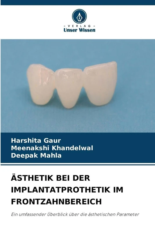 Ästhetik Bei Der Implantatprothetik Im Frontzahnbereich: Ein umfassender Überblick über die ästhetischen Parameter