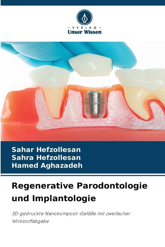 Regenerative Parodontologie und Implantologie: 3D-gedruckte Nanokomposit-Gefäße mit zweifacher Wirkstoffabgabe