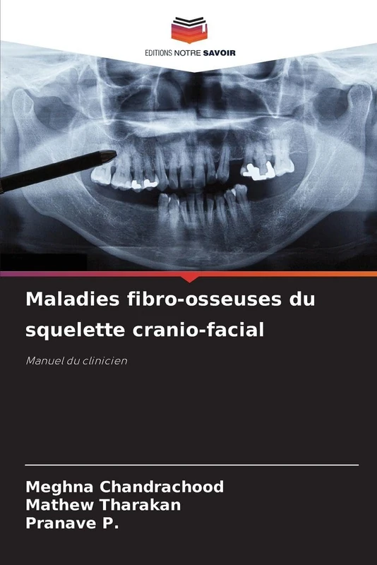 Maladies fibro-osseuses du squelette cranio-facial: Manuel du clinicien - Image 1
