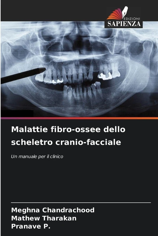 Malattie fibro-ossee dello scheletro cranio-facciale: Un manuale per il clinico