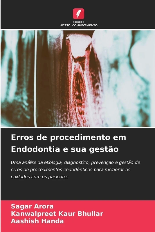 Erros de procedimento em Endodontia e sua gestão: Uma análise da etiologia, diagnóstico, prevenção e gestão de erros de procedimentos endodônticos para melhorar os cuidados com os pacientes