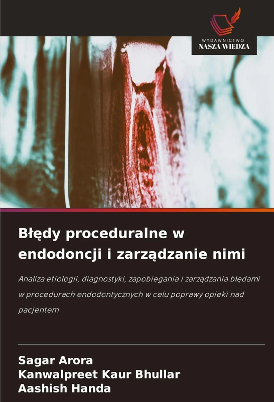 Blędy proceduralne w endodoncji i zarządzanie nimi: Analiza etiologii, diagnostyki, zapobiegania i zarz¿dzania b¿¿dami w procedurach endodontycznych w celu poprawy opieki nad pacjentem