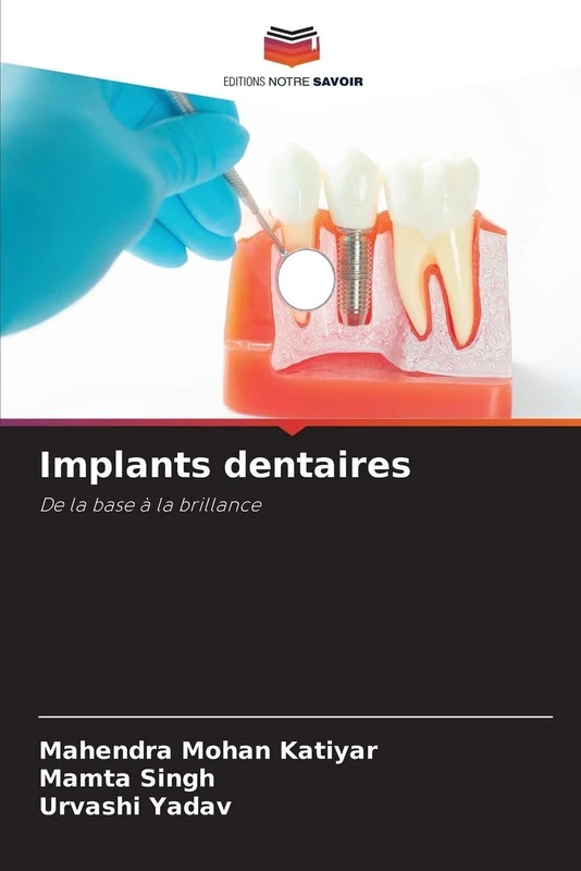 Implants dentaires: De la base à la brillance