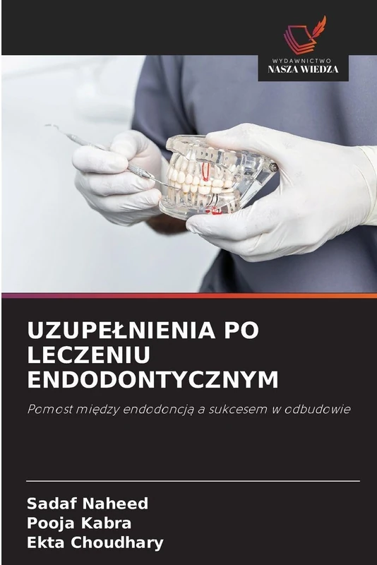 Uzupelnienia Po Leczeniu Endodontycznym: Pomost mi¿dzy endodoncj¿ a sukcesem w odbudowie