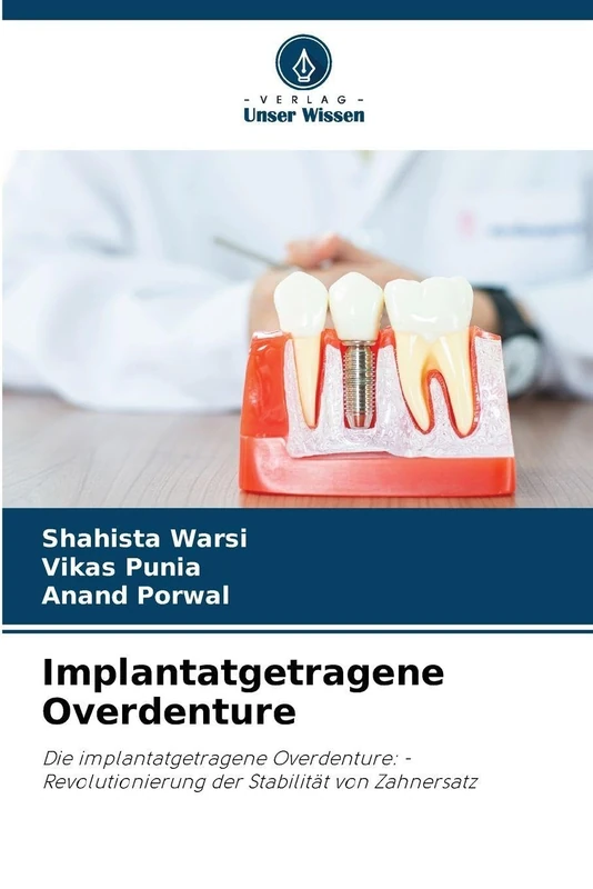 Implantatgetragene Overdenture: Die implantatgetragene Overdenture: - Revolutionierung der Stabilität von Zahnersatz