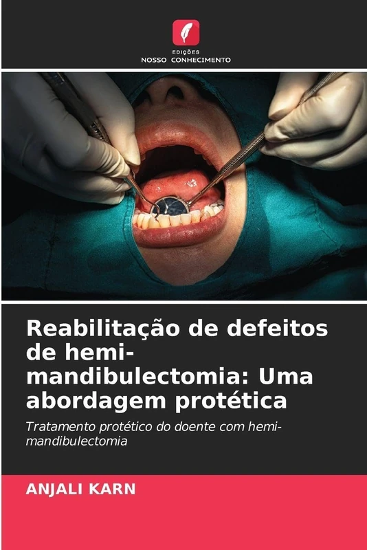 Reabilitação de defeitos de hemi-mandibulectomia: Uma abordagem protética