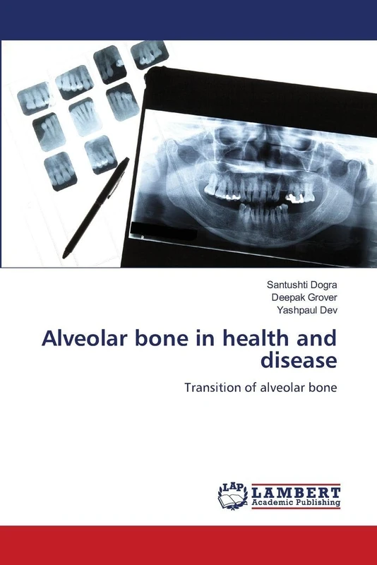 Alveolar bone in health and disease: Transition of alveolar bone