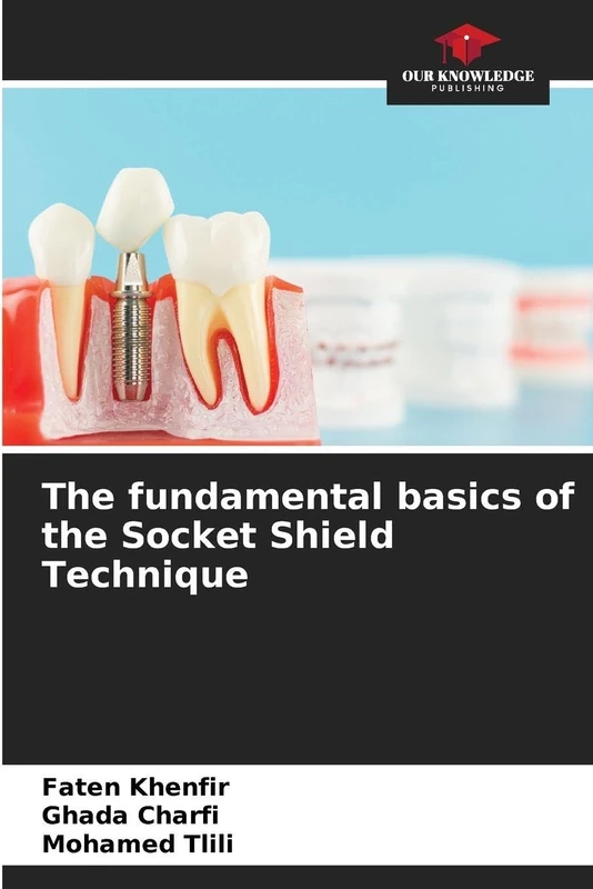 The fundamental basics of the Socket Shield Technique - Image 1